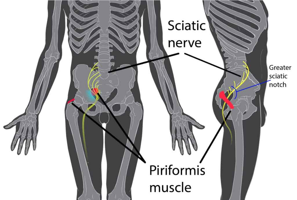 This shows the location of both the Sciatic Nerve and Piriformis Muscle